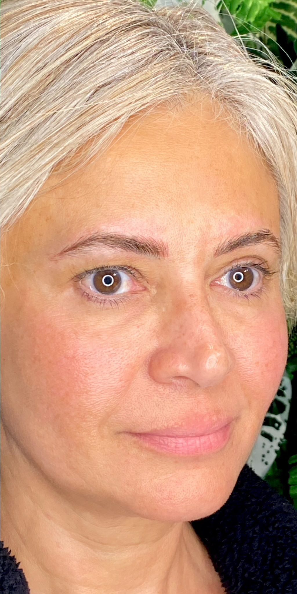 After Microblading