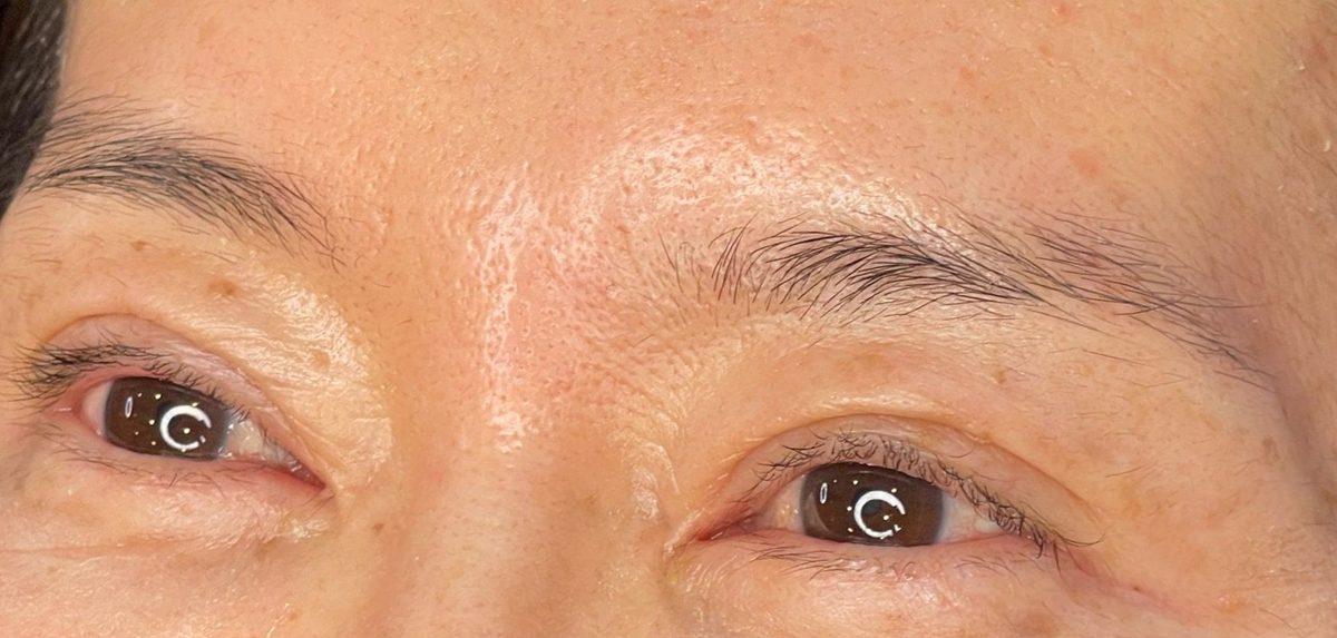 Before Microblading