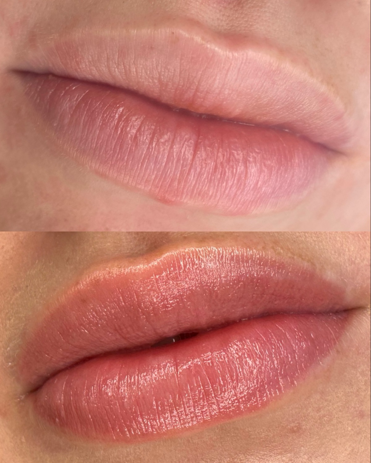 Lip blush result