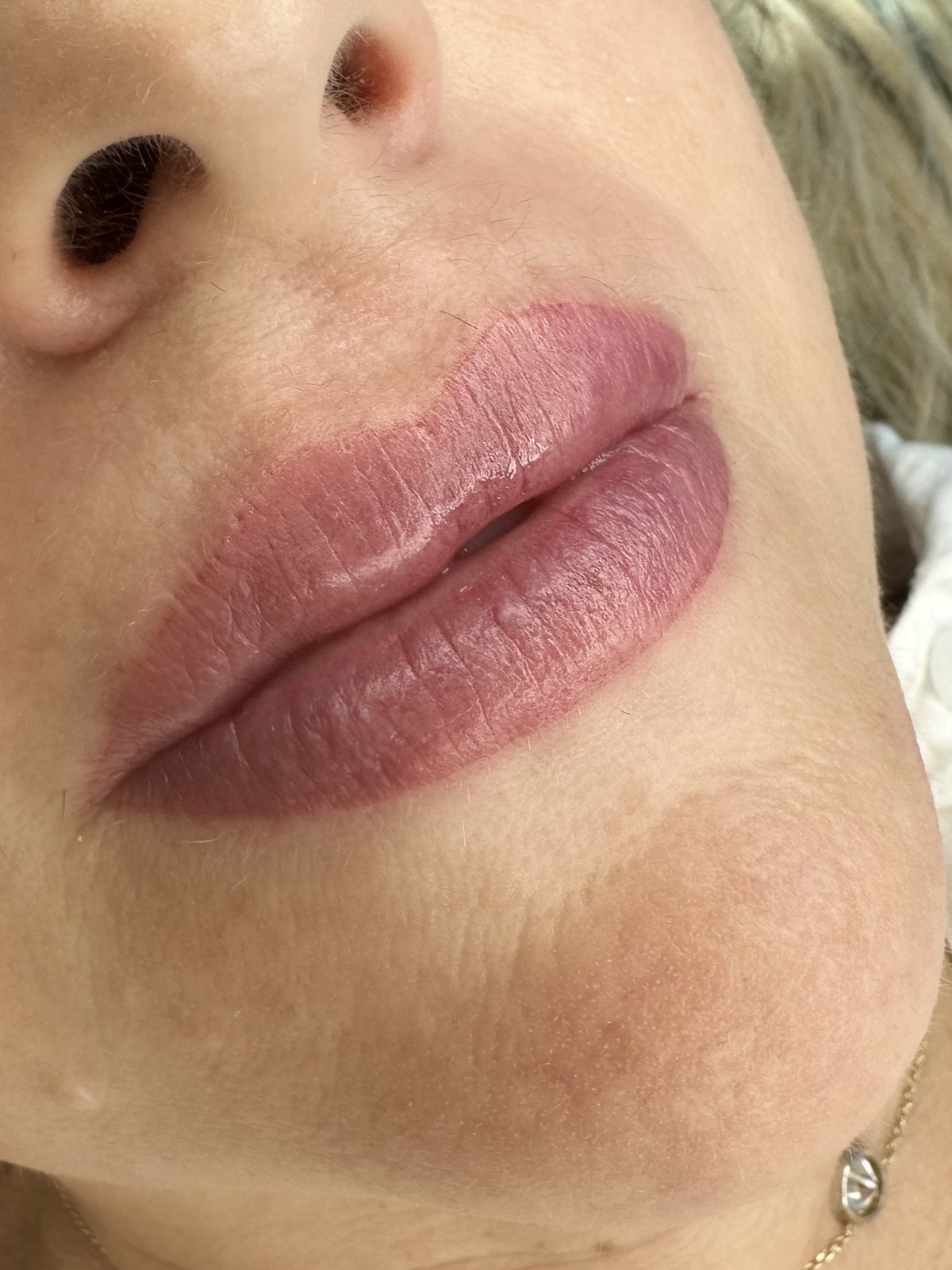 Lip blush result